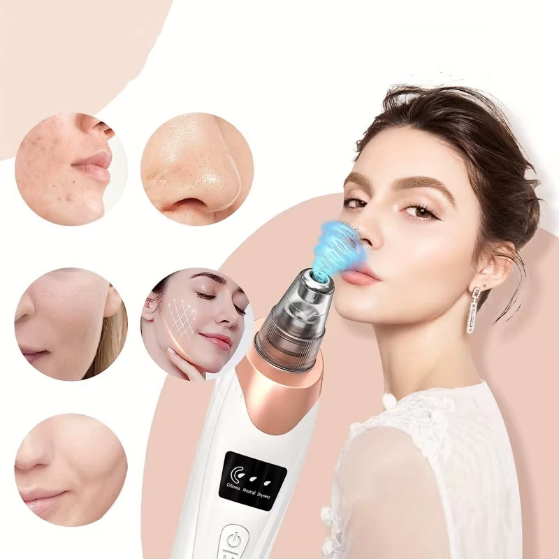Blackhead Remover Pore Vacuum - 5 Suction - USB Rejected Facial Pore Cleaner Kit for Adult Acne Extractor Tool