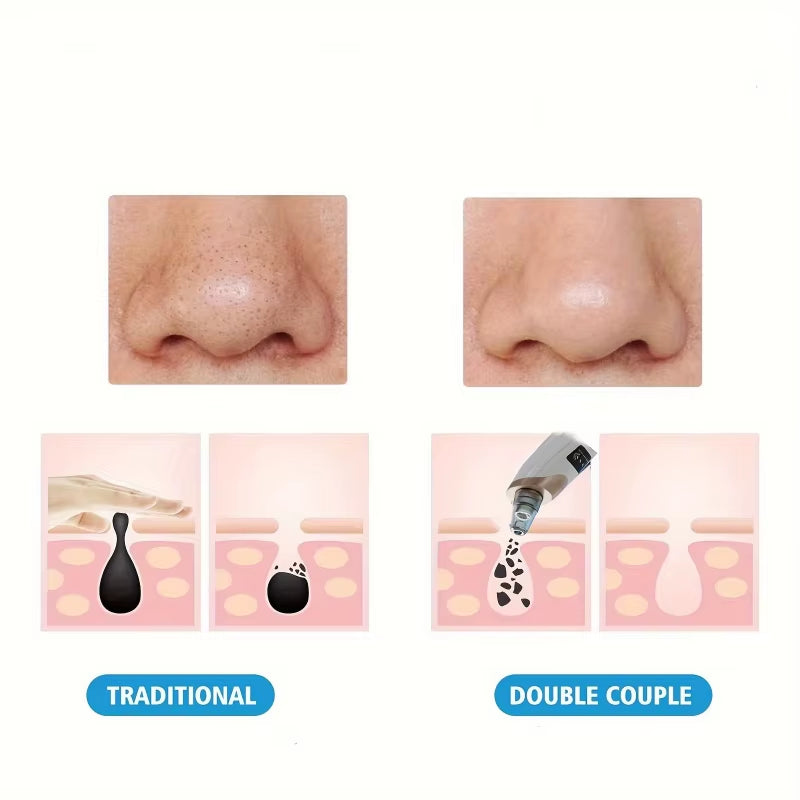 Blackhead Remover Pore Vacuum - 5 Suction - USB Rejected Facial Pore Cleaner Kit for Adult Acne Extractor Tool