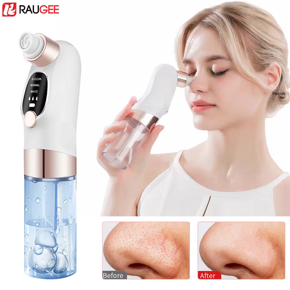 Blackhead Remover Electric Blackhead Extractor Pore Vacuum Cleaner Micro Small Bubble Acne Nose Deep Cleaning Black Head Remover