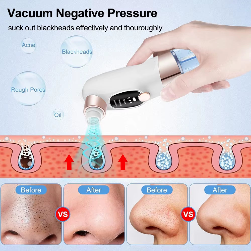 Blackhead Remover Electric Blackhead Extractor Pore Vacuum Cleaner Micro Small Bubble Acne Nose Deep Cleaning Black Head Remover