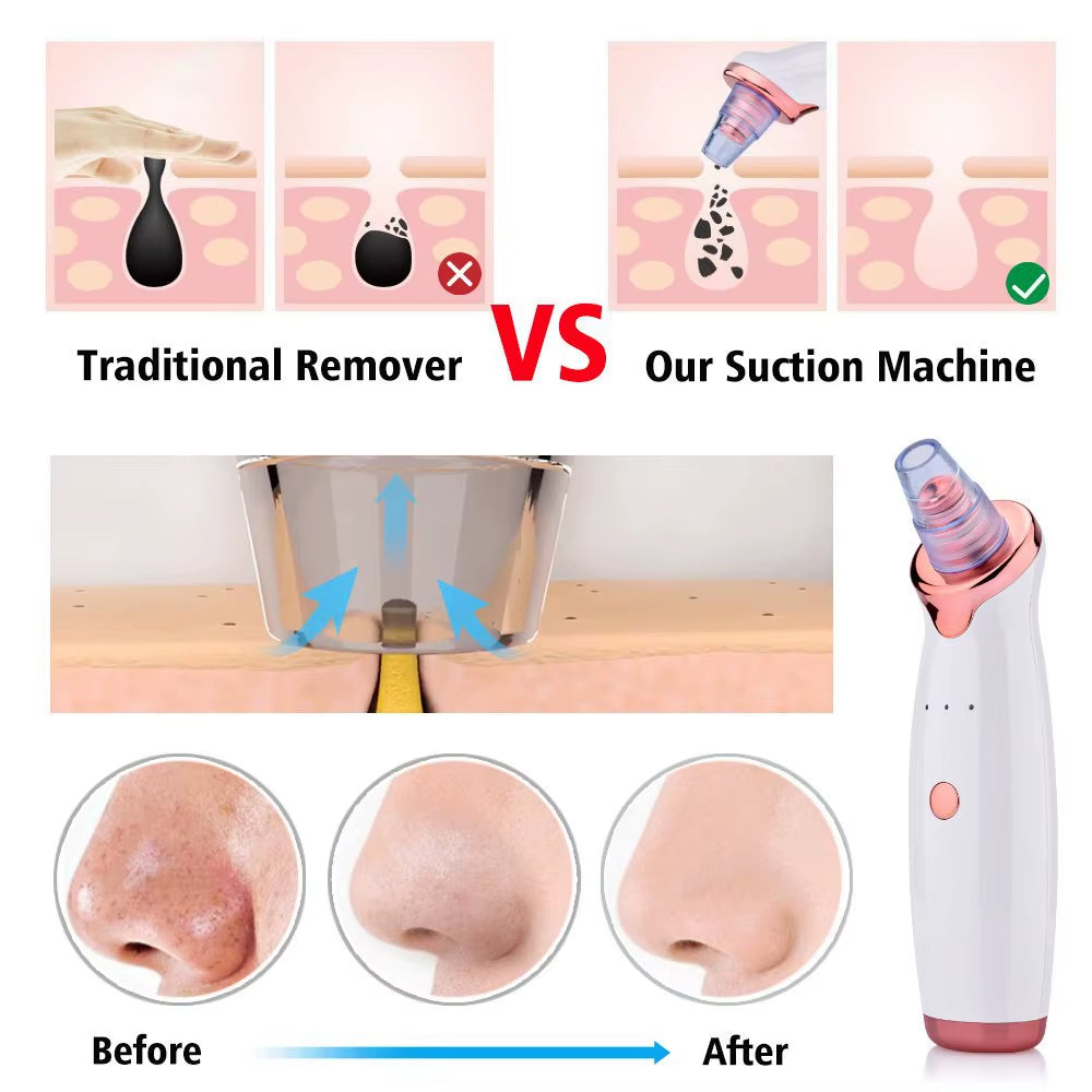 Blackhead Remover Vacuum Suction Pore Cleaner Acne Extractor Acne Comedone Whitehead Pimple Removal Spot Cleaner Skin Care Tool